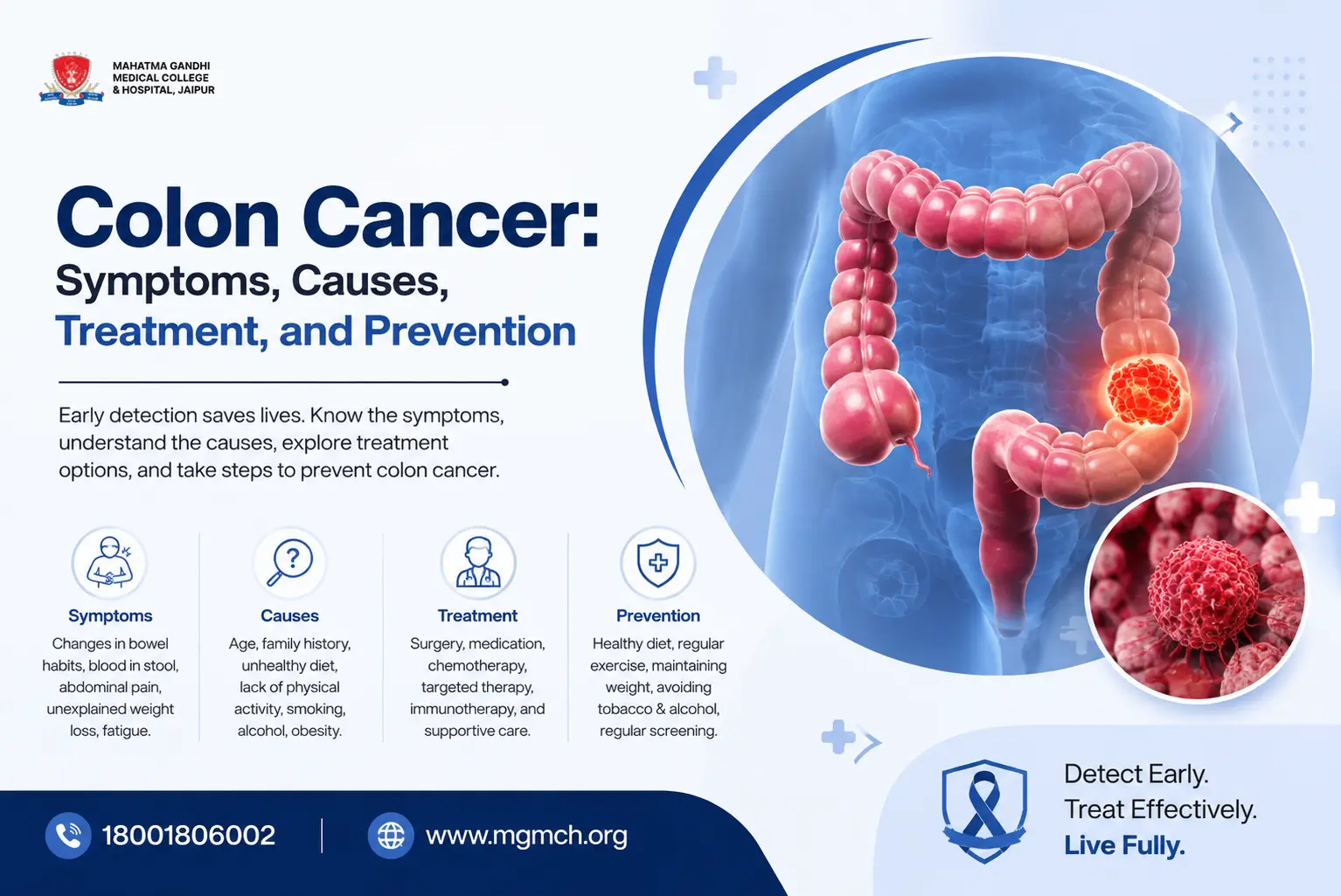 What is Colon Cancer?