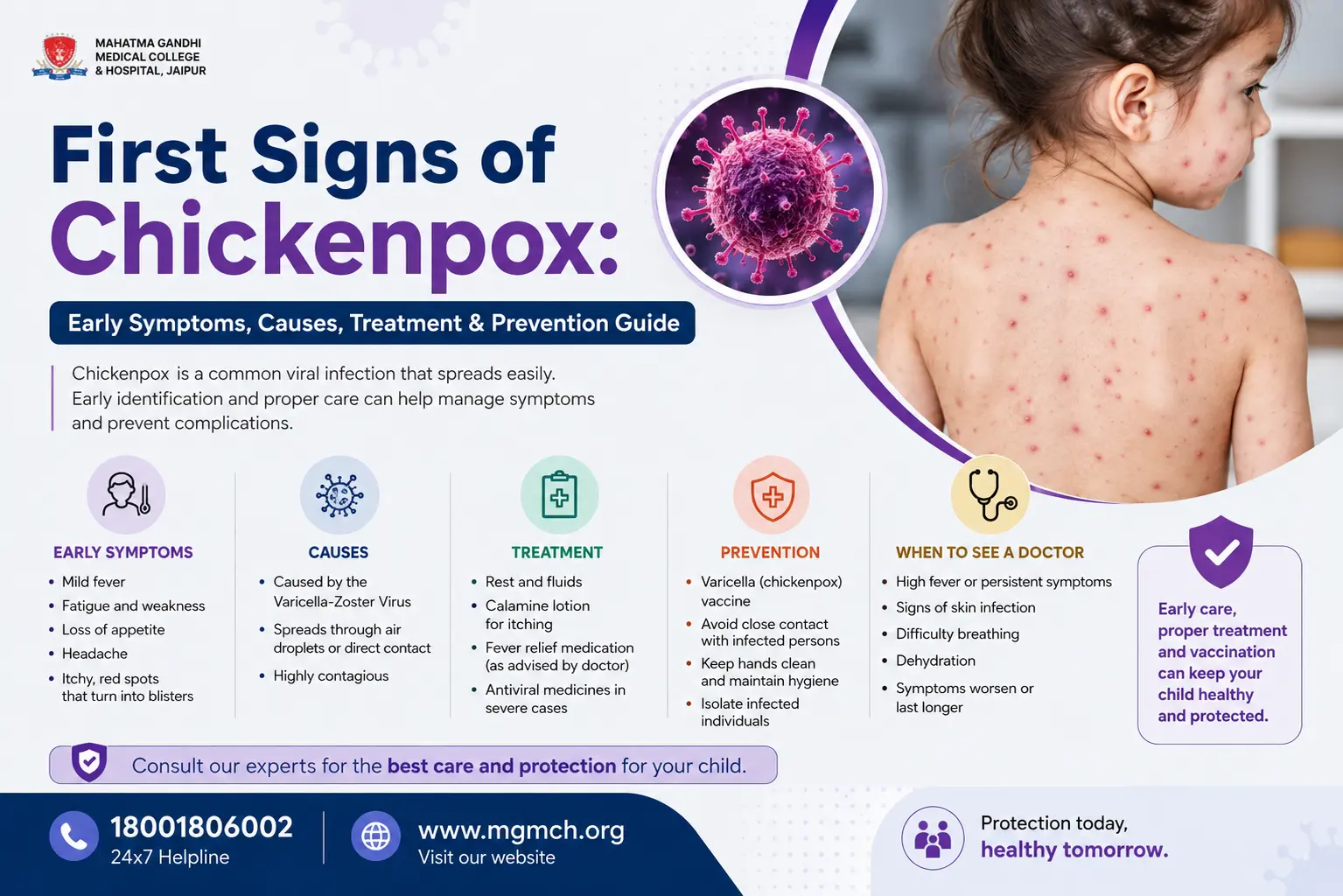 First Signs of Chickenpox