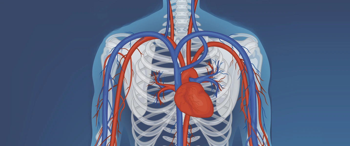 Aneurysm Repair